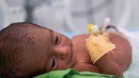 Natalité : Un enfant sur 10 dans le monde nait avant terme, alerte l’ONU
